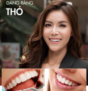 dáng răng thỏ đẹp